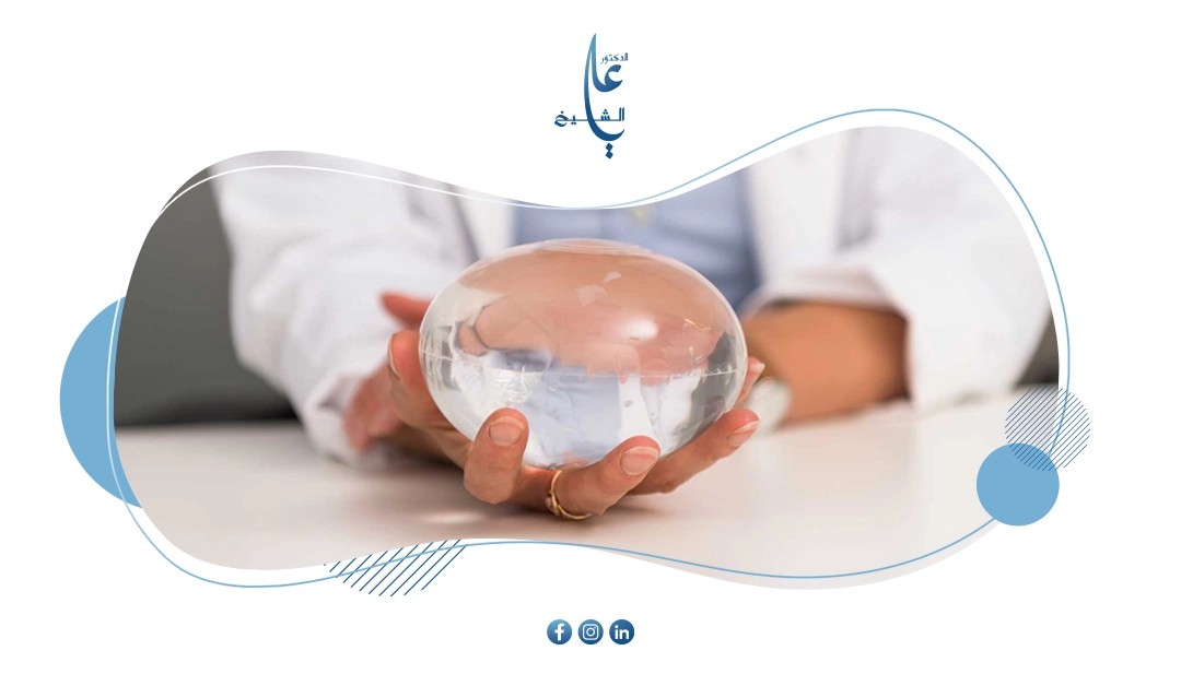 هل يعود الوزن بعد الكبسوله الذكيه - كيف تحافظ على النتائج