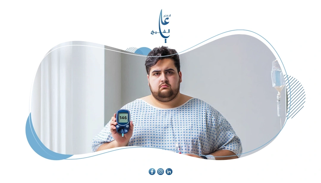هل عملية تكميم المعدة مفيدة لمرضى السكر