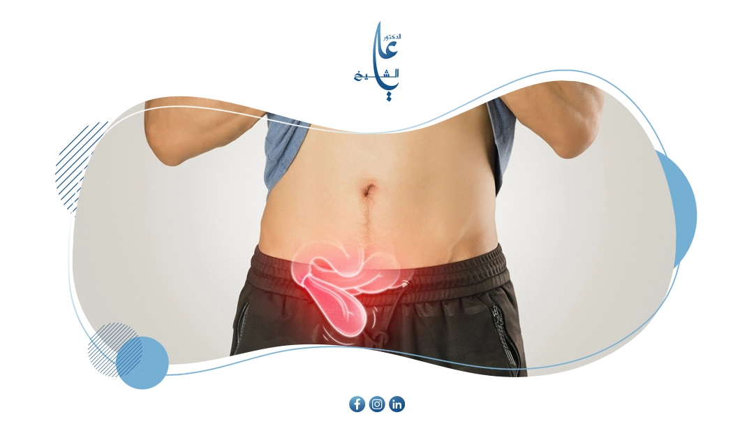 الدليل الشامل حول الفتق الجراحي بعد العمليات