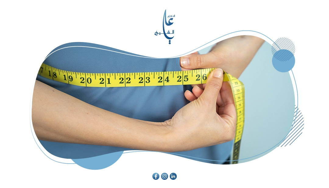 ما هي افضل عملية لإنقاص الوزن؟ دليل شامل لاختيار الجراحة المناسبة