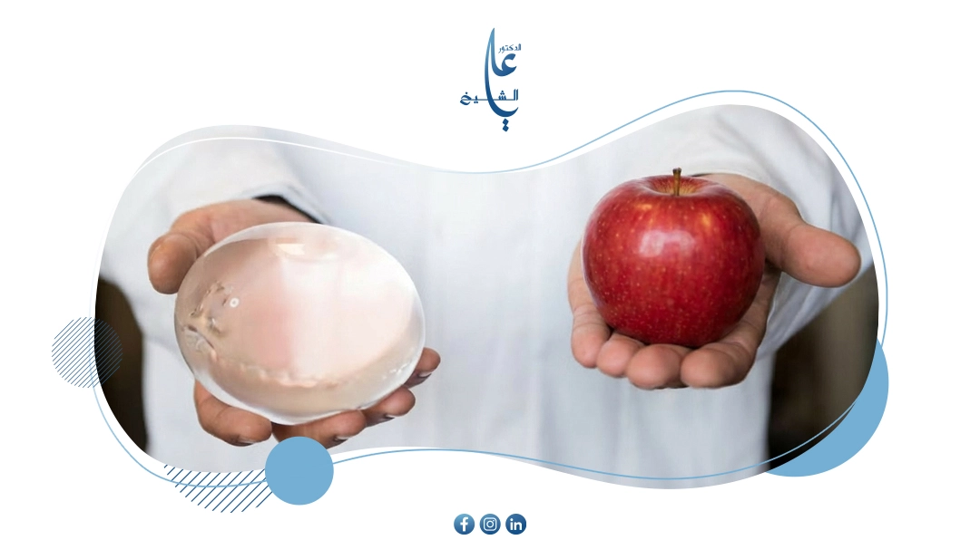 الكبسولة الذكية للمعدة: مقارنة شاملة مع الحميات الغذائية