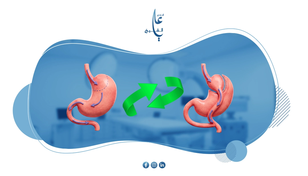 إلغاء عملية تحويل المسار: هل يمكن العودة للوضع الطبيعي؟