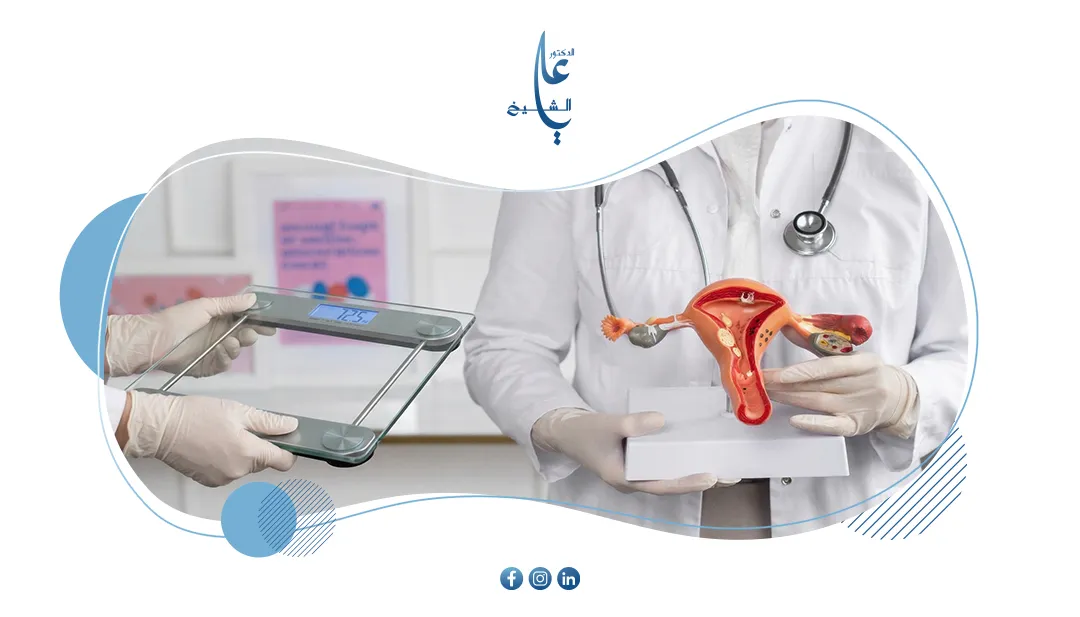 تكيس المبايض (PCOS) وزيادة الوزن: كيف تكسر العلاقة