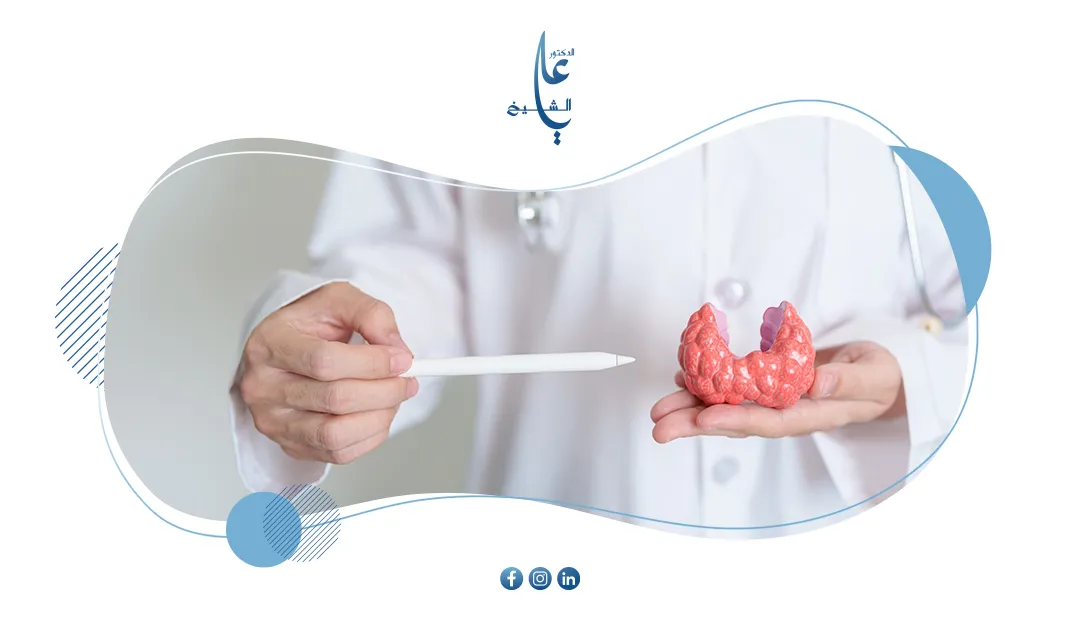 عملية استئصال الغدة الدرقية: الأسباب، و فترة التعافي