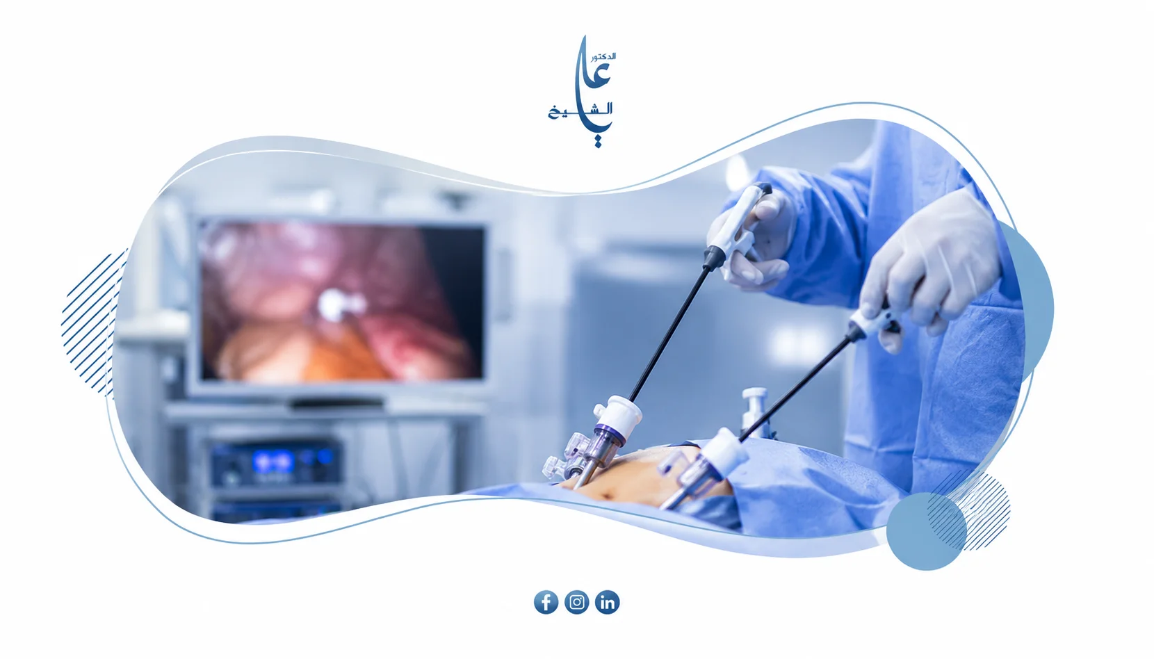 الجراحة بالمنظار أم الجراحة المفتوحة؟ أيهما أفضل لحالتك؟