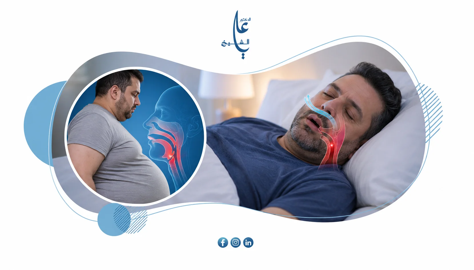 انقطاع التنفس أثناء النوم والسمنة: هل الوزن الزائد هو السبب؟