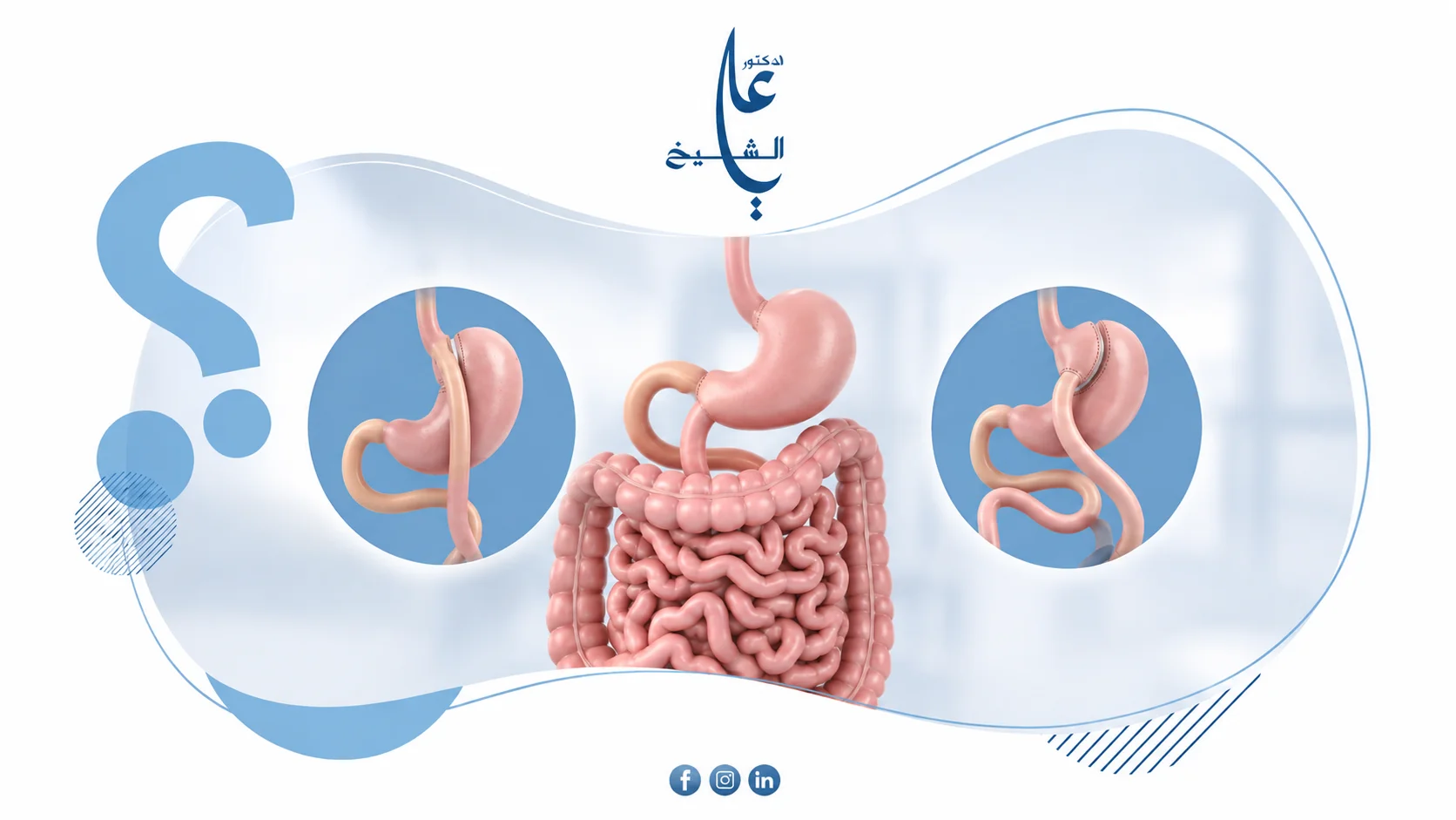 الفرق بين تحويل المسار المصغر والكلاسيكي: أيهما أنسب؟
